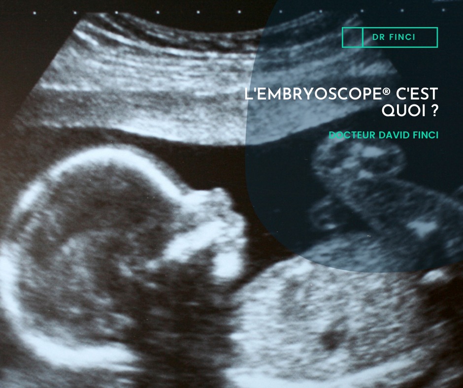 Embryoscope